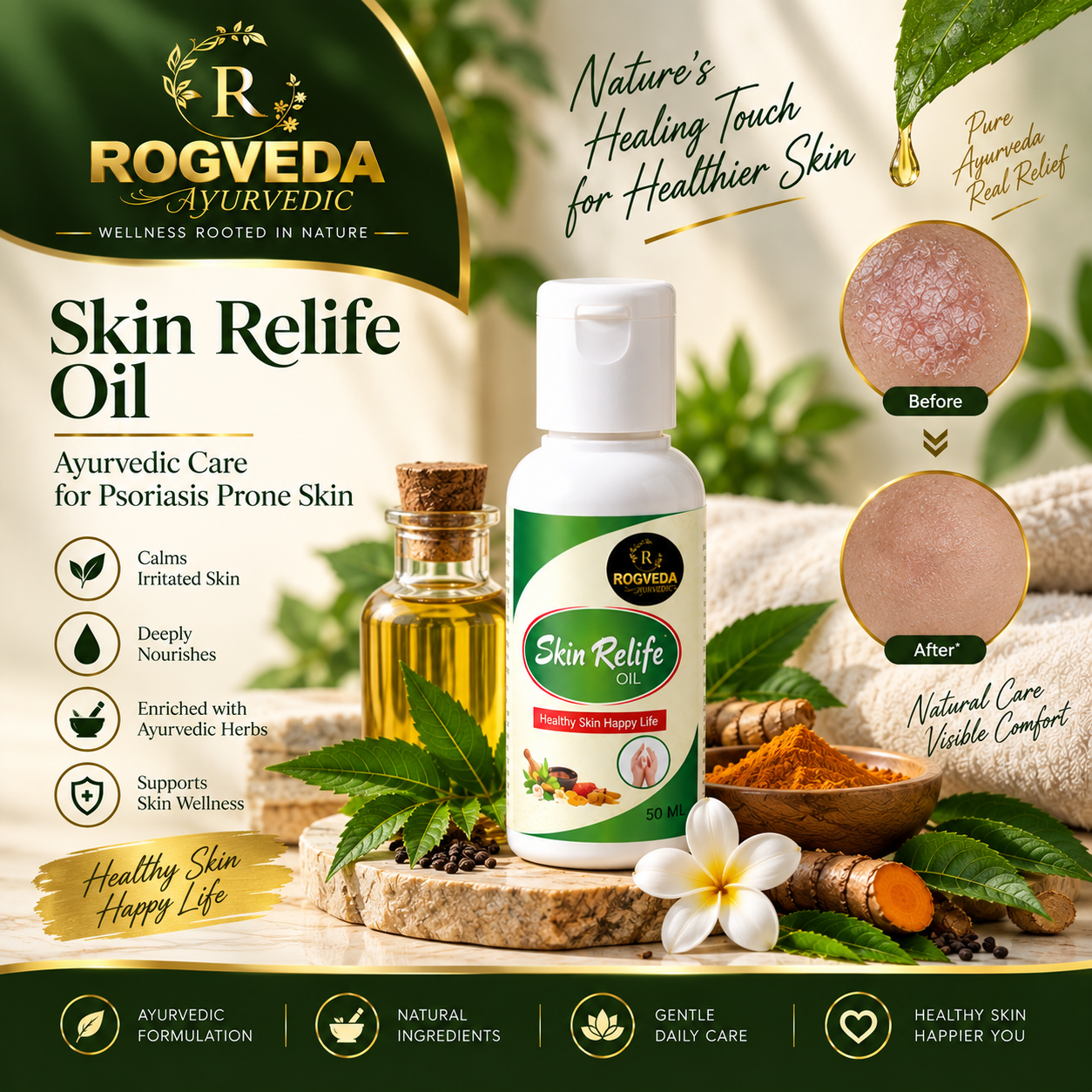 Rogveda Skin Relief Oil for Psoriasis Care - Image 2