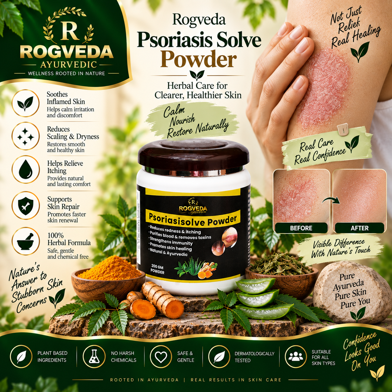 Psoriasis Solve Powder - Image 2