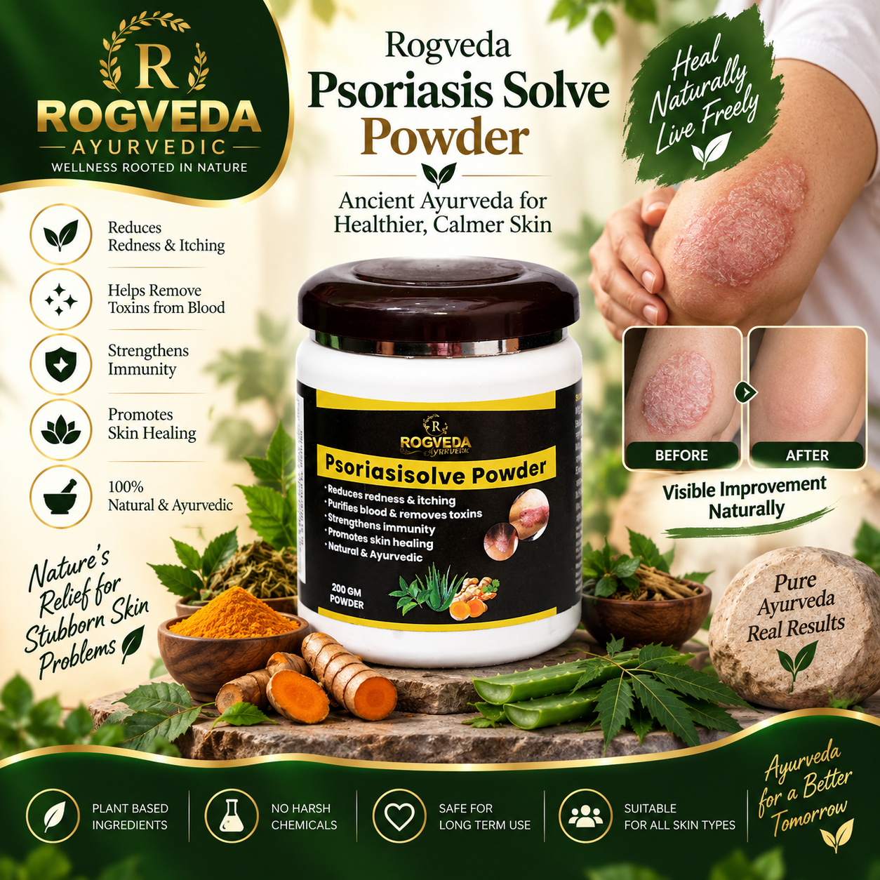 Psoriasis Solve Powder - Image 3
