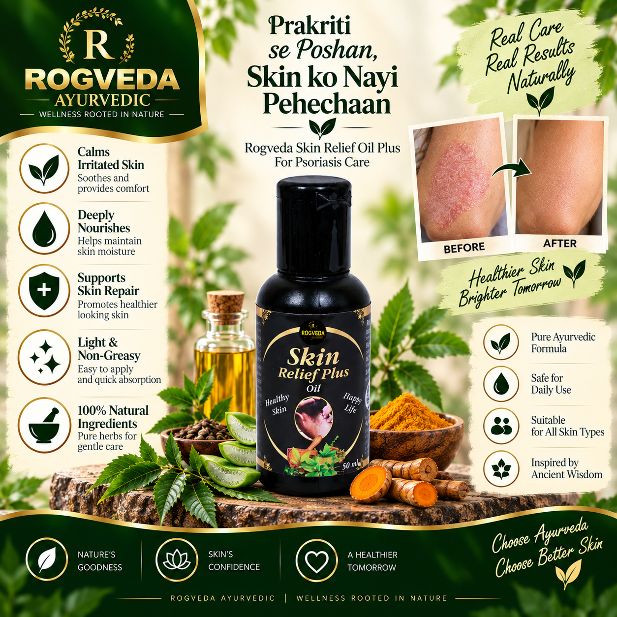 Rogveda Skin Relief Oil Plus for Psoriasis Care - Image 3
