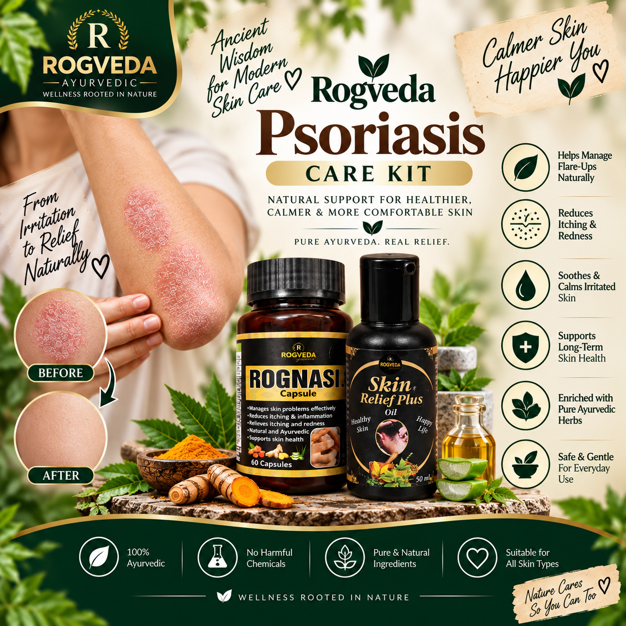 Rogveda Psoriasis Care Kit - Image 4