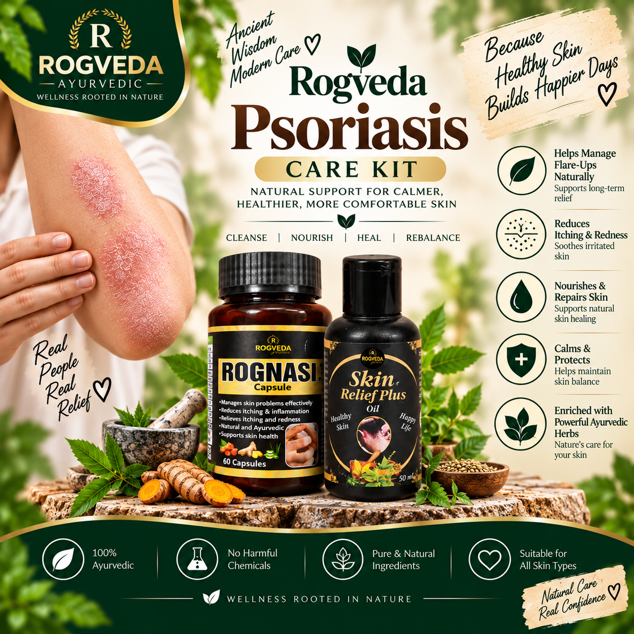 Rogveda Psoriasis Care Kit - Image 2