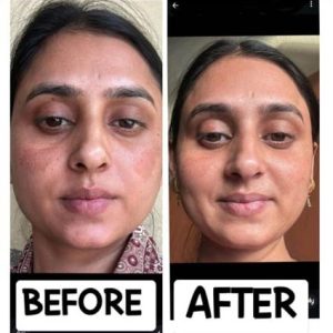 Pigmentation Care